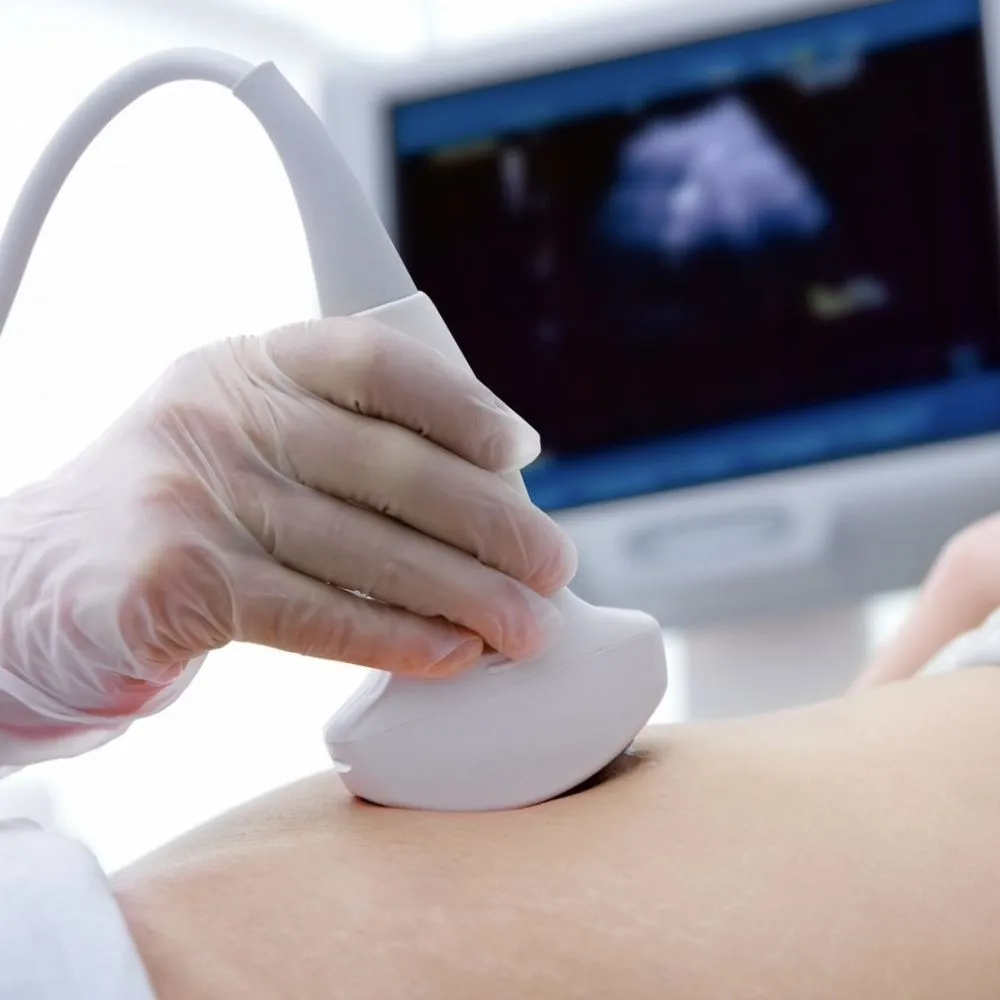 УЗИ в родах
