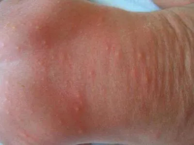 5318837076906602142.jpg Извлечение